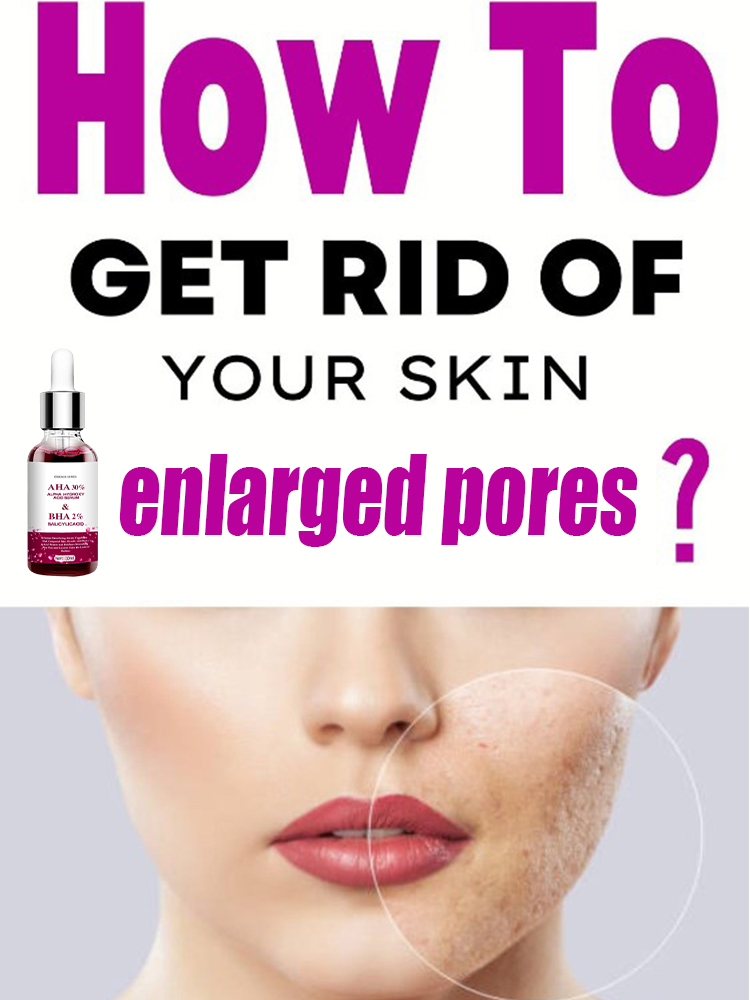 모공 축소 세럼 살리실산 과일산 함유 블랙헤드 제거 오 - Salicylic Acid Blackhead Remover 리뷰 및 가격