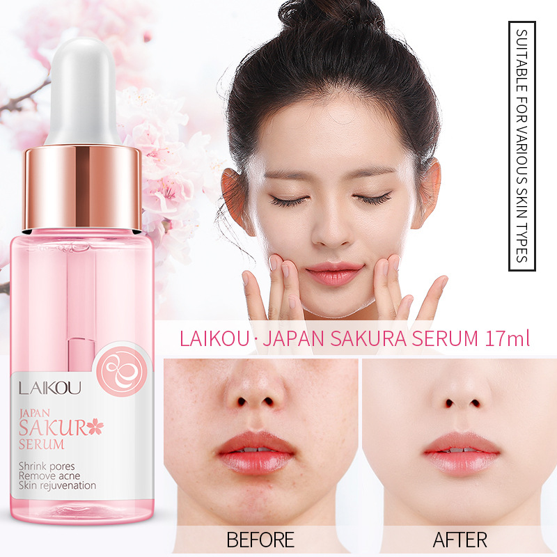 LAIKOU 사쿠라 세럼 및 콜라겐 페이스 크림, 체리 - Niacinamide Pore Shrinking Essence 리뷰 및 가격