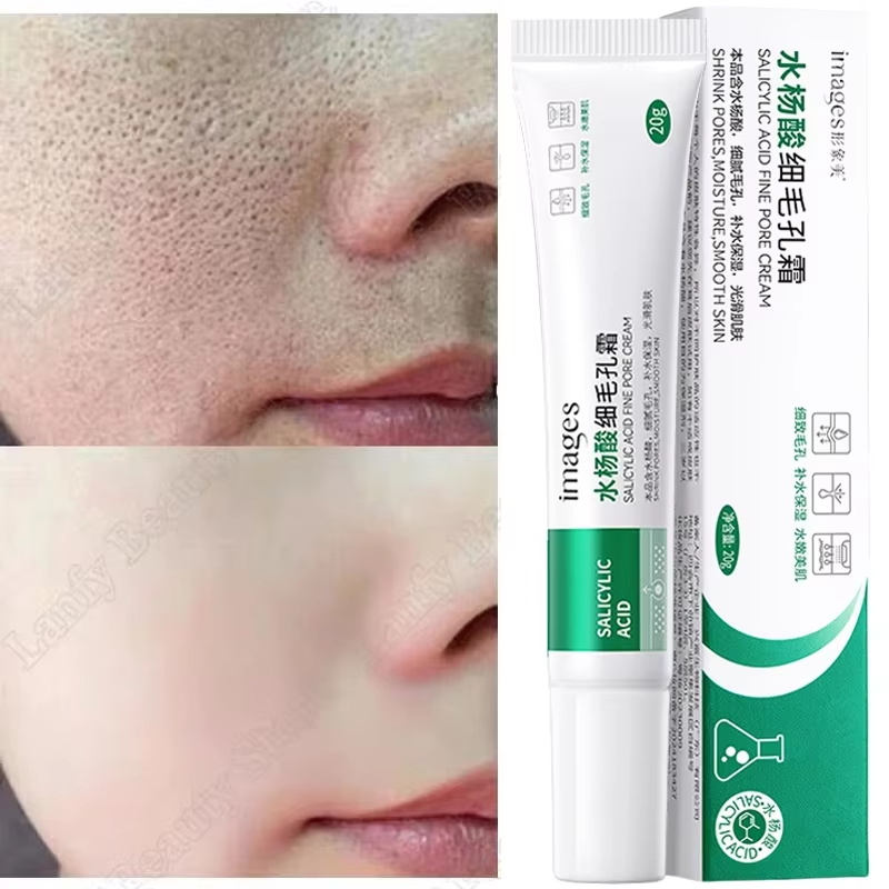 살리실산 모공 클리어링 크림 모공 축소 블랙헤드 제거  - Salicylic Acid Blackhead Remover 리뷰 및 가격