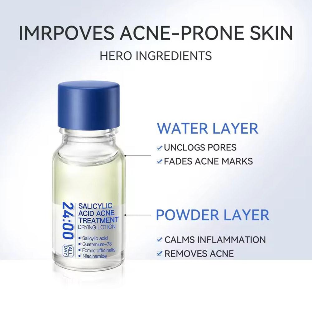 살리실산 여드름 제거제 블랙헤드 오일 컨트롤 모공을 부 - Salicylic Acid Blackhead Remover 리뷰 및 가격